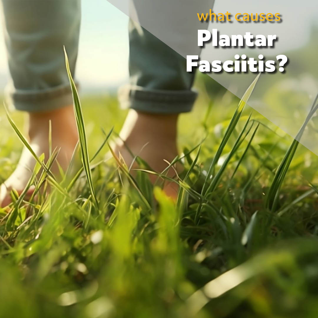 What causes plantar fasciitis?